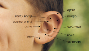 ניתוח הצמדת אוזניים עם ד